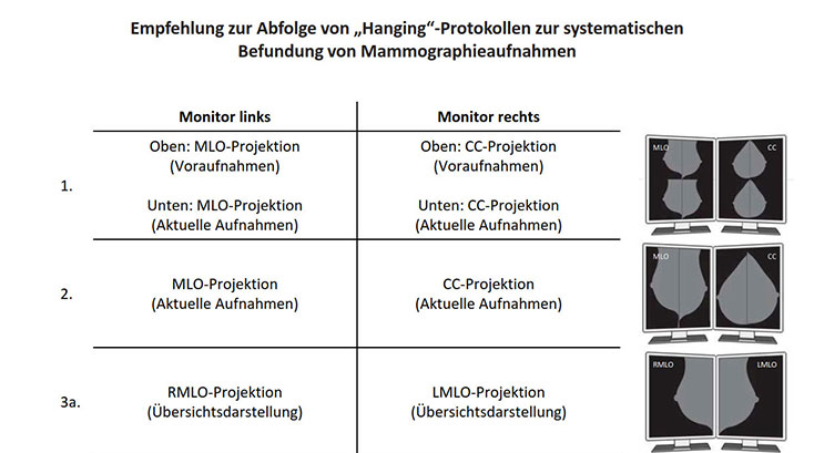  Systematische Befundung von Mammographieaufnahmen